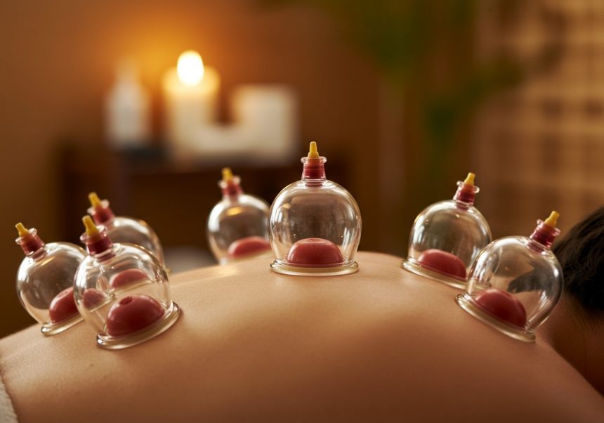 Na chrbte sú umiestnené sklenené poháre na bankovanie, ktoré vytvárajú vákuum.